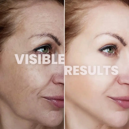 BrightaSkin™ Collagen Glow Up Mask